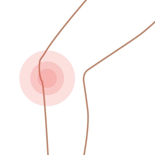膝の痛み