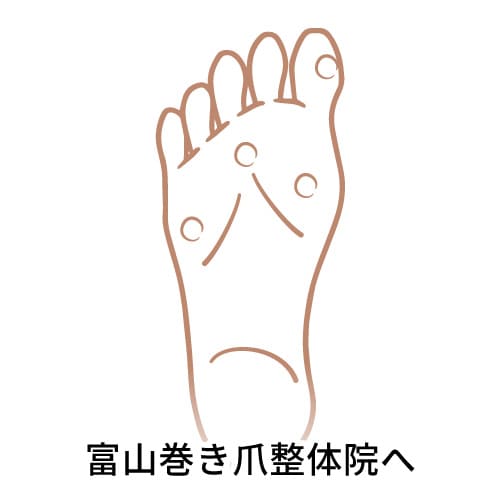 タコ・ウオノメ