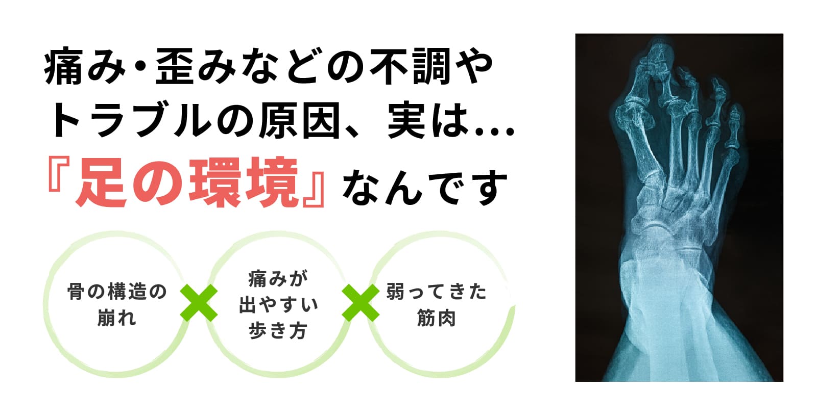 痛み・歪みなどの不調やトラブルの原因、実は…『足の環境』なんです